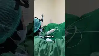 Operasi Fistula Ani Hanya 15 Menit Dengan Fillac