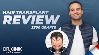 Greffe de cheveux Dr Cinik | FUE | 3300 greffons | Résultats de la croissance des cheveux en 6 mois