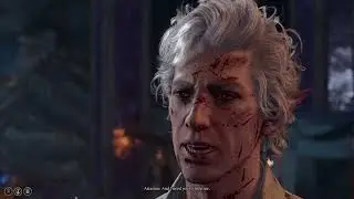 Act II | The truth about Astarions scars