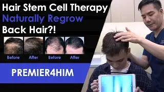 Hair Stem Cell Therapy Says YES to Healthier, Regrown Hair!