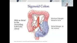 Webinars for the Global Surgical Community - Operative Standards for Colon Cancer