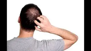 itch - SOUND EFFECT