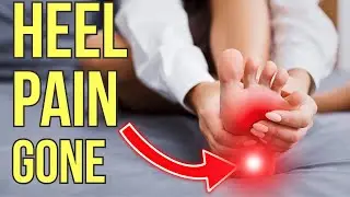 If Walking Hurts...Try This for Your Plantar Fasciitis | Dr. Chris Cameron Chiropractor in Lucan ON