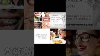 Scovolino Dentale: i benefici per la salute dei tuoi denti e gengive