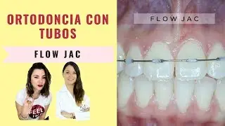 Ortodoncia SIN brackets - OMG Ahora con Tubos?? Flowjac