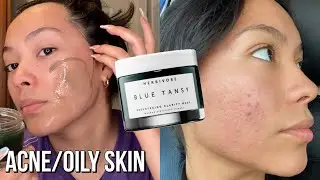 Herbivore Blue Tansy Mask Review | Acne Skin Review