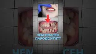 ПОТЕРЯЕТЕ зуб и даже НЕ заметите! #ВладимирОрдовский #стоматология #здоровье