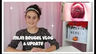 Mijn beugel VLOG + update