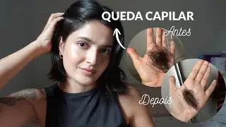 Queda capilar! entenda os motivos e os tratamentos | MEU caso real! 
