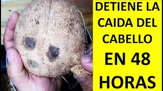 Esto me ayud&oacute; con las canas y la ca&iacute;da del cabello&ndash;Remedio natural que uso en casa, ami no me falla.