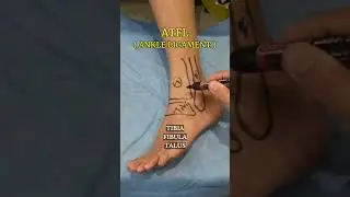 Anatomy of the Ankle Joint: Bones and Their Functions.