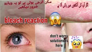 bleach karny ka tarika|eyes redness solution|nagina shah#2023 #bleach #whitening bleach