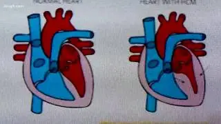 Healthlink: genetic testing of the heart