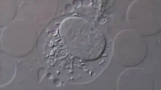 Моноцит иммунная клетка крупным планом. Monocyte immune cell magnification 5000х