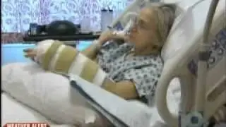 Riverside Methodist Hospital Surgeon Reattaches Patient's Hand