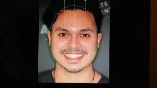 digital smile design