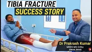 Tibia Fracture Success Story||Dr Prakash Kumar MBBS MS Ortho|| Bike exident received 2 Month
