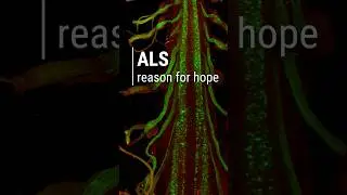 Breakthrough could lead to an ALS cure