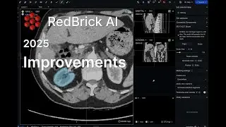 Redbrick AI - What's new from 2025