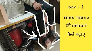 Tibia - Fibula Height Growth Day - 1 । घर बैठे Life Time Challenge Height Grow Kre #challenge 