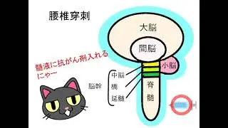 必見‼白血病　骨髄穿刺？腰椎穿刺？