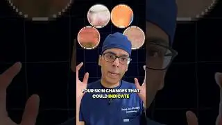 Doctor Sethi : 4 Skin Changes That Could Indicate Liver Disease ❌