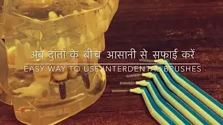 अब दांतों के बीच आसानी से सफाई करें| Easy way to use interdental brushes| Hindi - Dr. Radha Raut