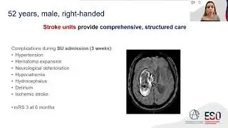 ESO-EANS Guideline on stroke due to spontaneous intracerebral haemorrhage