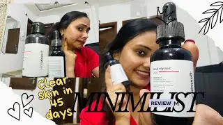 Minimalist Salicylic Acid 2% Serum + 3% PHA Toner Honest Review | Clear Skin in 45 Days 