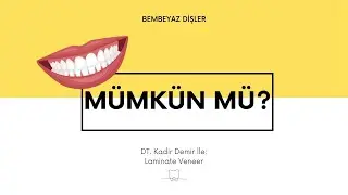 LAMİNATE VENEER NEDİR ?