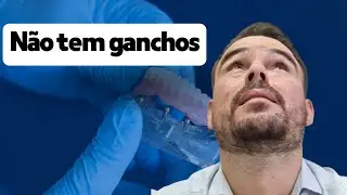 4 opções de PRÓTESE REMOVÍVEL  com metal e sem metal