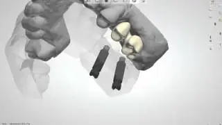 23518