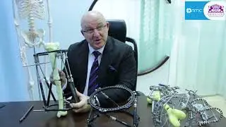 BRMS Orthopaedics: Taylor Spatial Frame