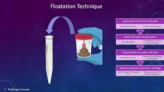 Concentration techniques in Stool | Floatation techniques | Sedimentation techniques | parasites