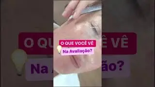 AVALIA&Ccedil;&Atilde;O FACIAL #esteticista #estetica #peelingquimico #jumeajuda