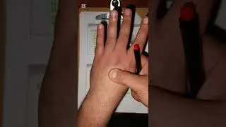 شرح BURNS  باطني مرحلة رابعة