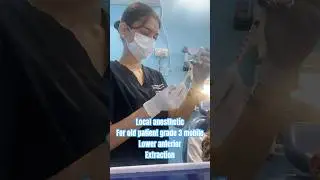 #trending #dentalcare #dentition #dental #dentalclinic #dentistry #dentist #shorts #youtube #short