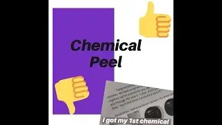 I GOT A PCA CHEMICAL PEEL at Massage Envy! (review)