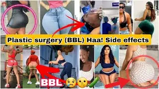 Nollywood Actresses Who do Plastic Surgery Nigerian celebrities who did BBL 🤣( #nollywood sc0ck)
