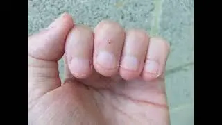62 : nail biting spit and hands fetish journey in 2025 / Evolution de mes mains et ongles en 2025(6)