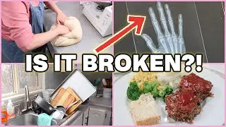Жизнь домохозяйки со сломанным пальцем?