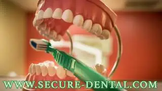 Secure Dental - The Best Place for Dental Cleaning