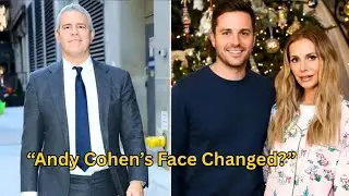 Andy Cohen BREAKS Silence on Rumors He Changed His Face