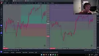 Trade Recap 18 | -$330 Trade Like a Robot