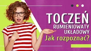 Toczeń Rumieniowaty Układowy 👉 Trudne Objawy ❤️ Jak Wykryć Toczeń | Medycyna360