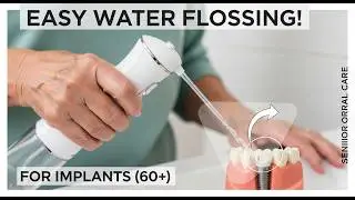 Best Water Flosser for Implants (60+)