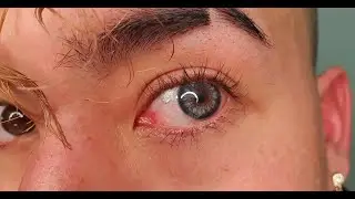 BEST Blue Contacts For Dark Asian Eyes / ColorCL Siesta Crystal Halo Sky | DPartyIsHere