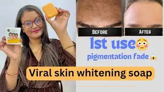 *viral soap | I tried Jiore skin whitening soap | pigmentation fade😱
