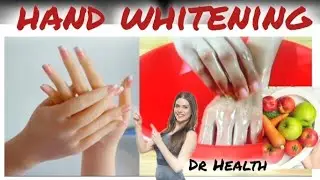 🛑Remove Darkness of Hands in 15 mints at Home Dr Health