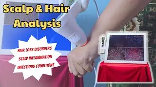 7 Inch LCD Scalp Detector Digital Hair Skin Analyzer Microscope for Hair Follicle Testing and Skin